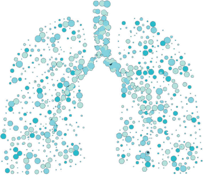 Lung anatomy